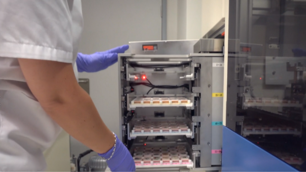 El problema del análisis de muestras en España: los patólogos denuncian la falta de inversión, tecnología y personal