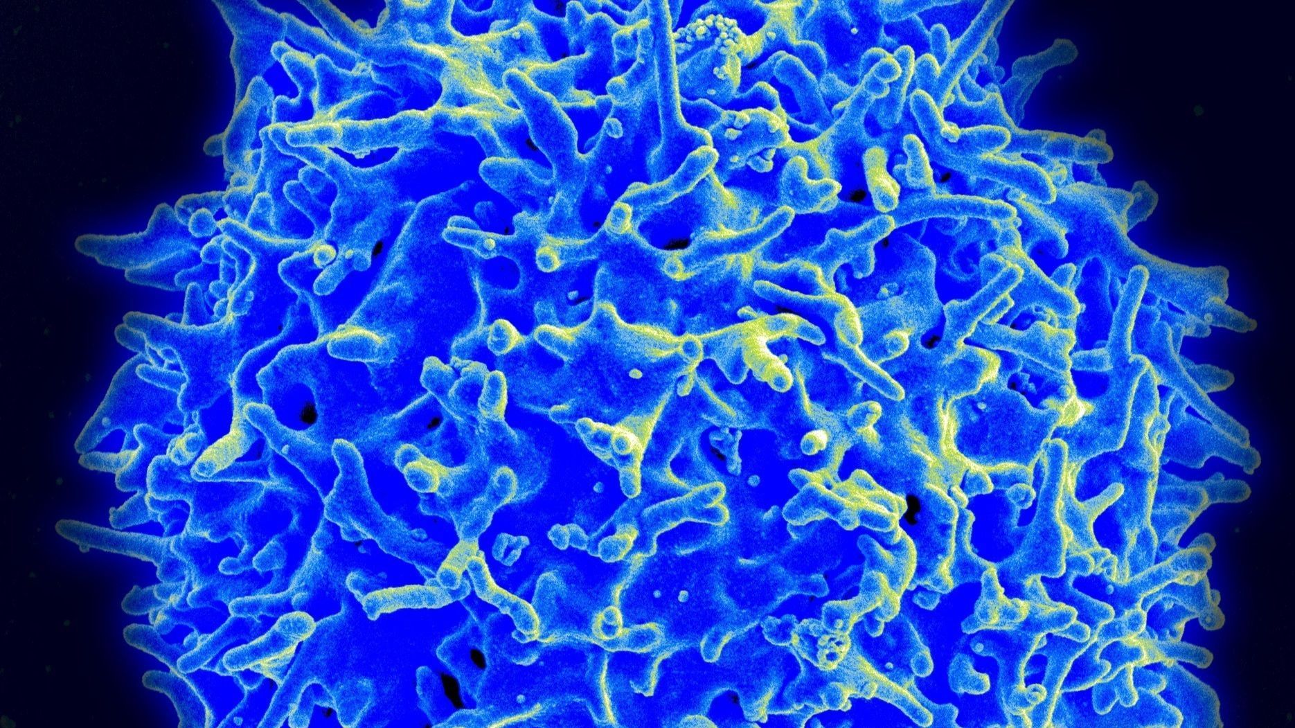 Imagen de micrografía de un linfocito T humano del sistema inmunitario. Imagen de micrografía de un linfocito T humano del sistema inmunitario.