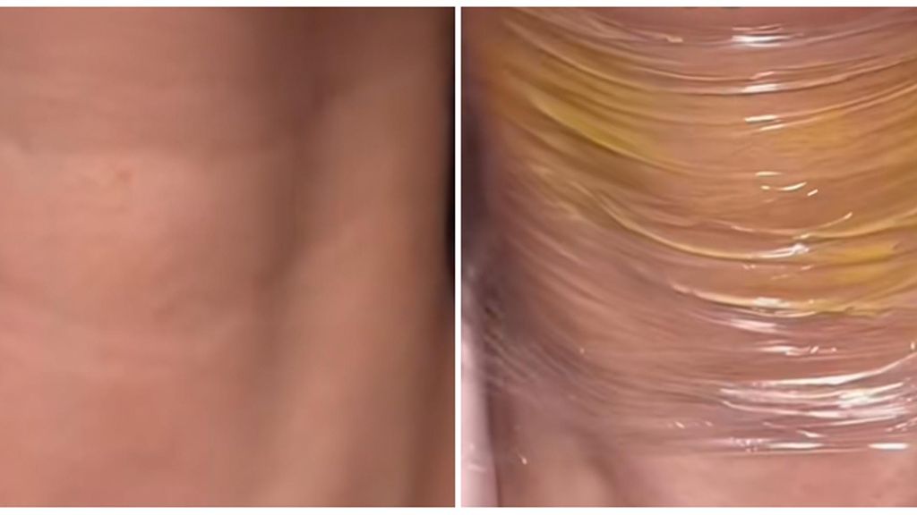 El truco viral de aplicar retinal en el cuello para acabar con las arrugas